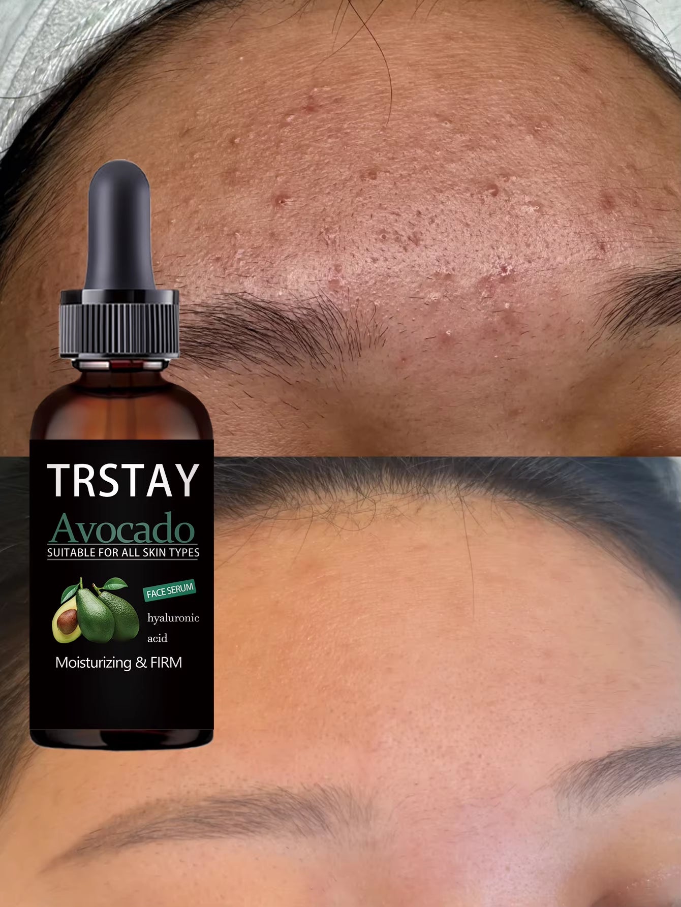 5Ml/15Ml/30Ml/50Ml/Hyaluronic Acid Avocado Anti-Aging Shrinkage of Pores Whitening Moisturizing Essence Oil Cuticle Oil Control