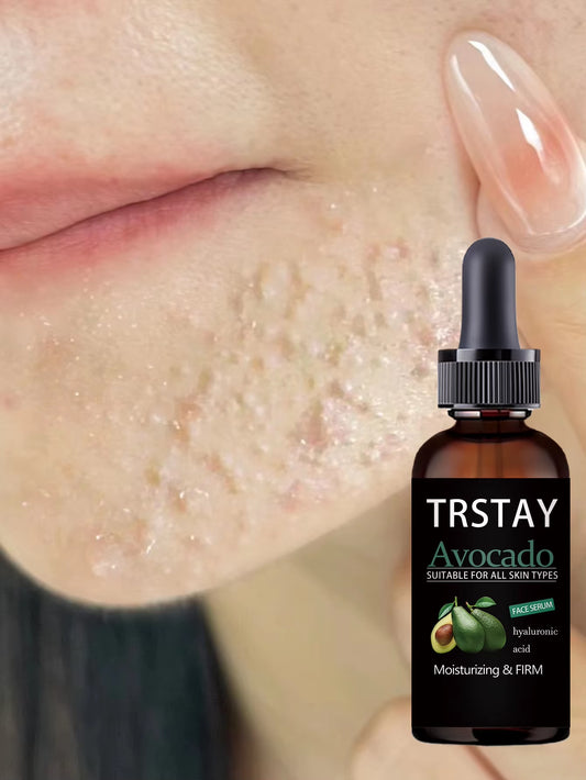 5Ml/15Ml/30Ml/50Ml/Hyaluronic Acid Avocado Anti-Aging Shrinkage of Pores Whitening Moisturizing Essence Oil Cuticle Oil Control